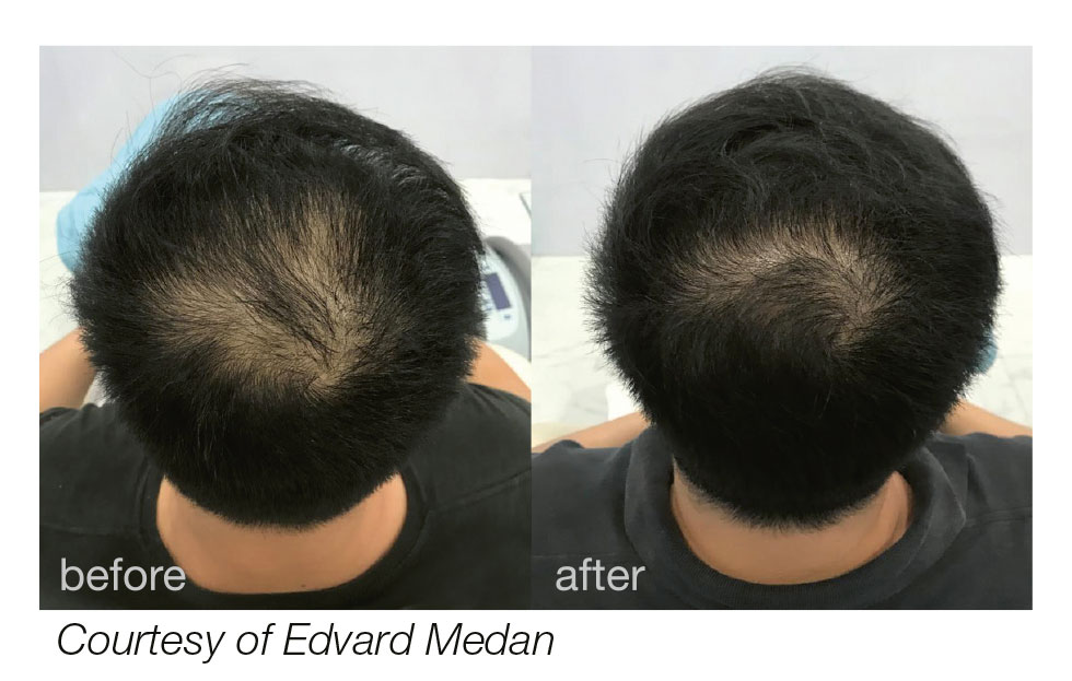 hairestart_web_b_a_courtesy_of_edvard_medan