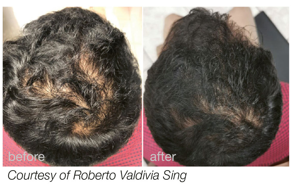 hairestart_web_b_a_courtesy_of_roberto_valdivia_sing